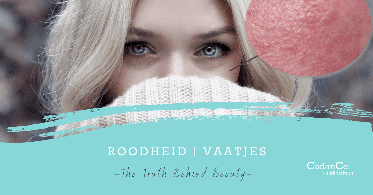 Blog-roodheid-vaatjes