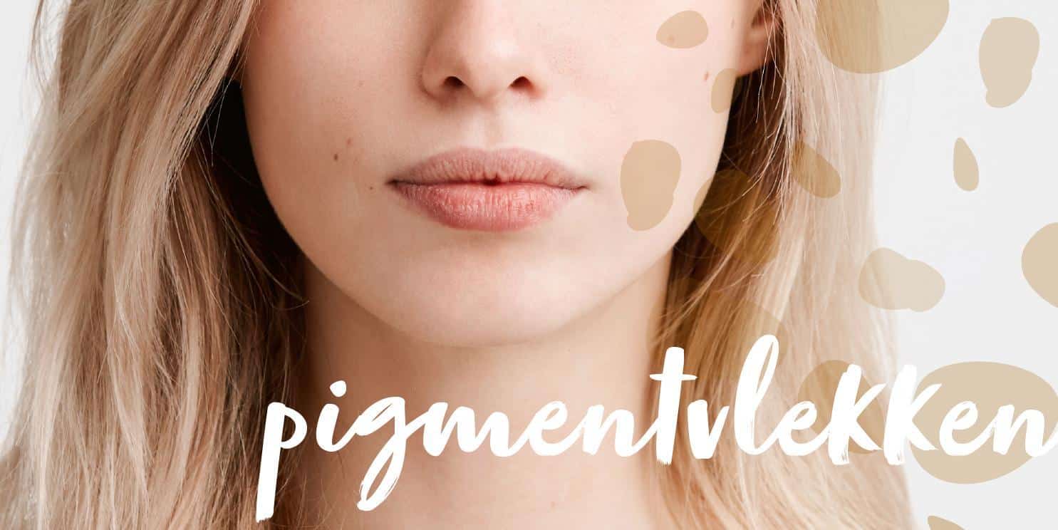 Pigmentvlekken-1